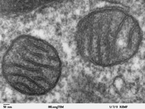 What mitochondria look like under an electron microscope. They're the round objects.